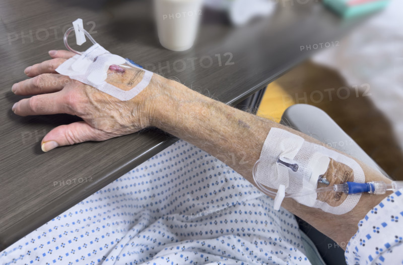 Hospital patient with IV ports inserted in his hand and forearm
