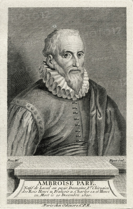 Ambroise Paré