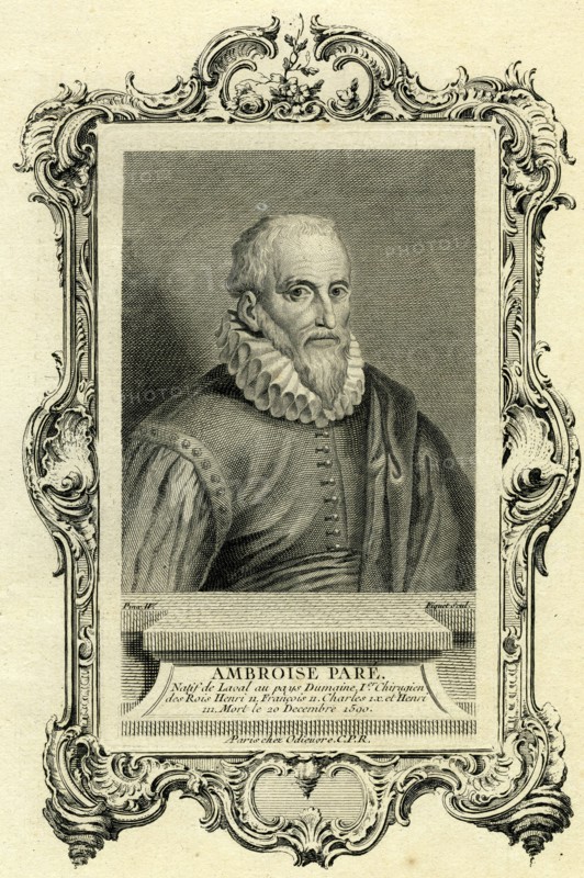 Ambroise Paré
