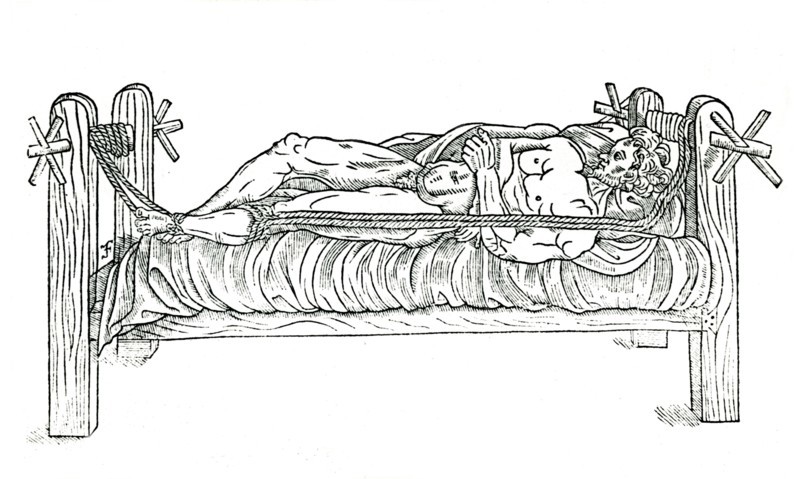 Apparatus for reducing dislocations, 1544. Artist: Unknown