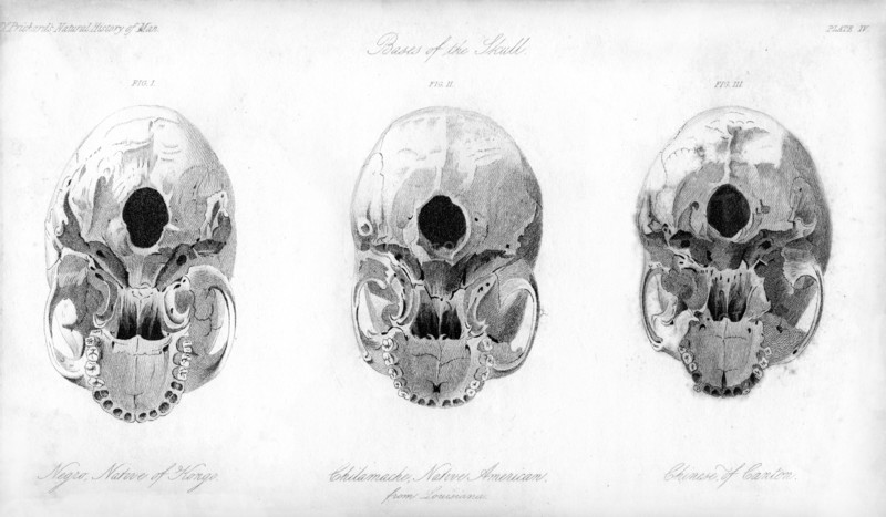 Base of the skull, 1848. Artist: Unknown