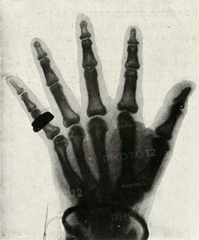 'Radiograph of the Hand of H.R.H. The Prince of Wales', (c1897). Artist: Unknown.