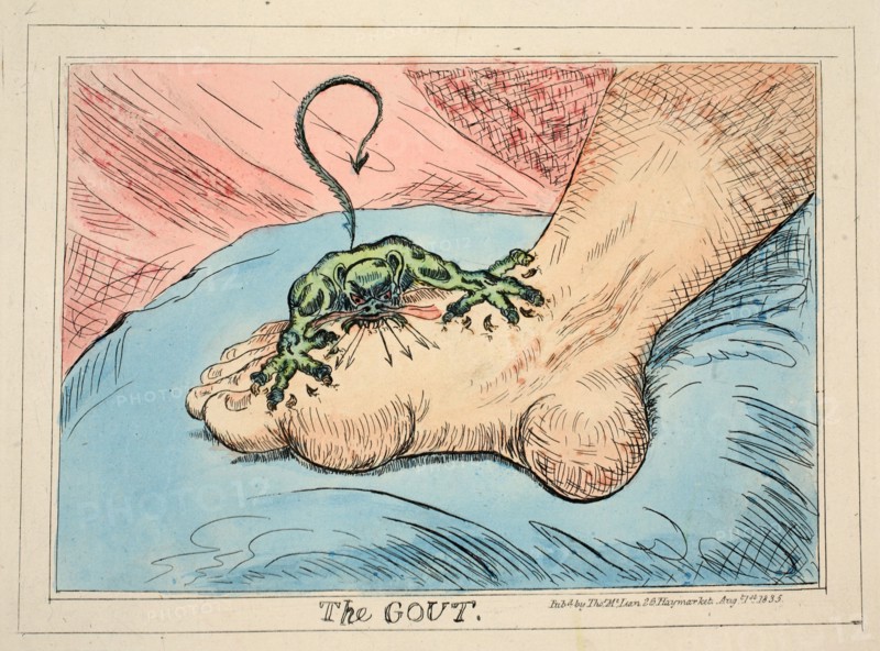 The Gout, 1835.
