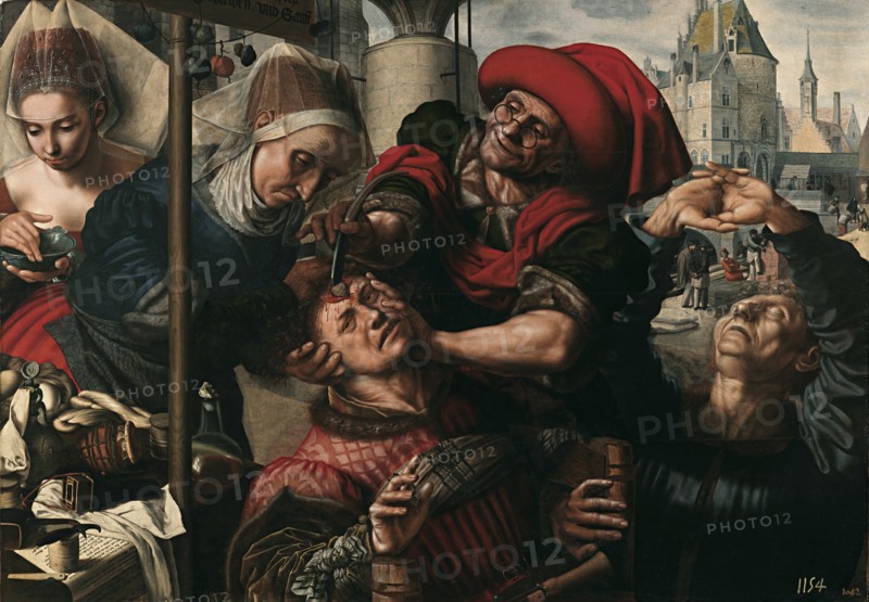 Surgery, 1550-1555. Artist: Hemessen, Jan Sanders, van (c. 1500-c. 1566)