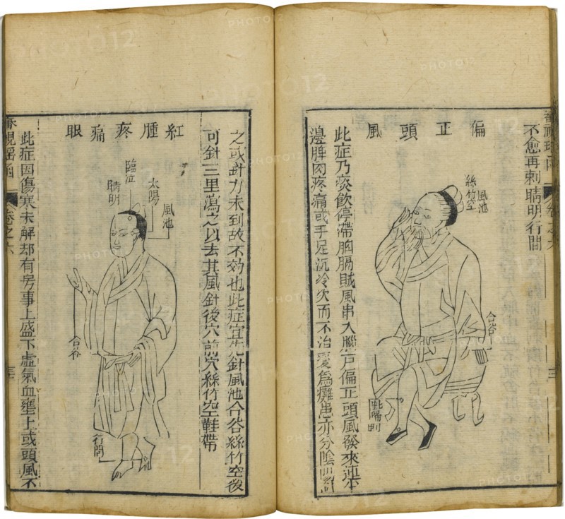 Shen Shi Yao Han (A Precious Book of Ophthalmology), 1644. Artist: Fu Renyu (active Mid of 17th cen.)