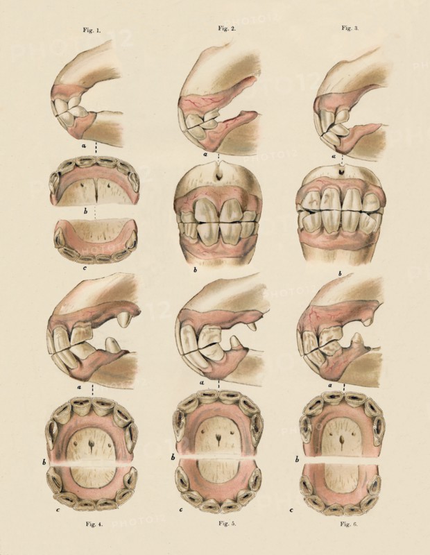 Description of Plate Showing the Age, As Indicated By The Teeth', c1879.