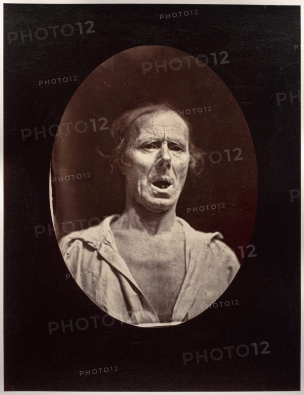 Figure 54: Abaissement volontaire de la mâchoire inférieure: mouvement inexpressif, c. 1856. Creator: Guillaume-Benjamin-Amand Duchenne (de Boulogne) (French, 1806-1875); Adrien Tournachon (French, 1825-1903).