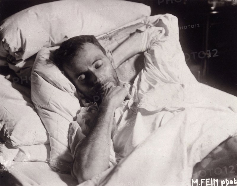 Egon Schiele on his Deathbed, 1918. Creator: Fein, Martha