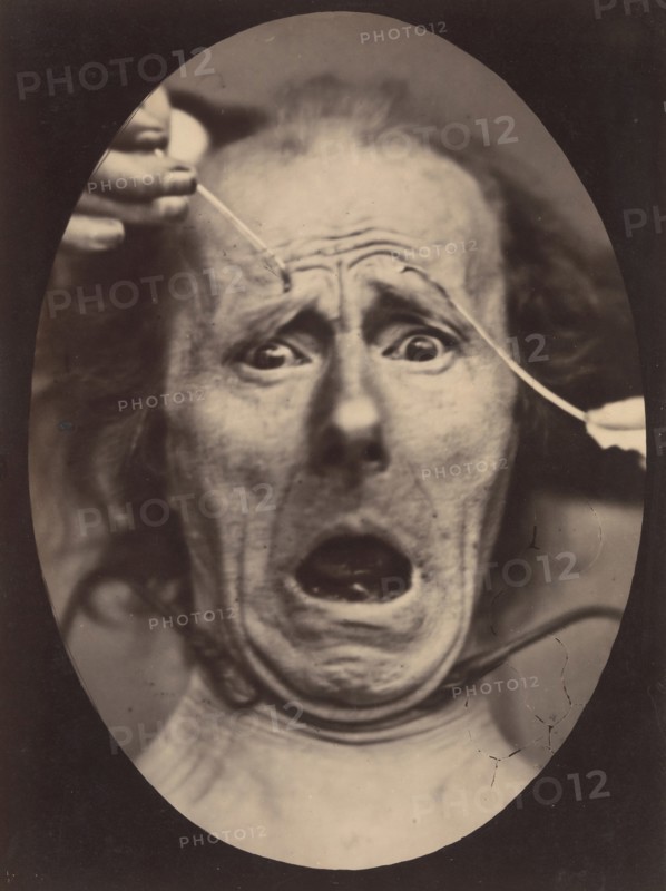 Electro-Physiologie, Figure 64, 1854-56, printed 1862.