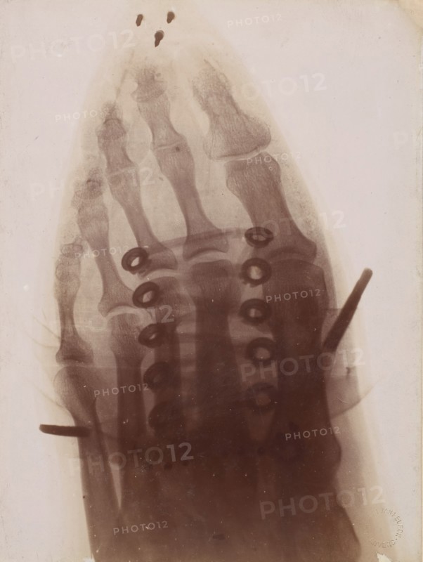 Le pied à travers la chaussure, 1896.