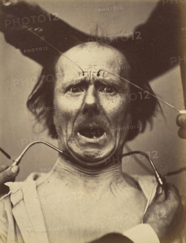 Icono-photographique. Mécanisme de la Physionomie Humaine. Fig. 65, 1854-56, printed 1862.