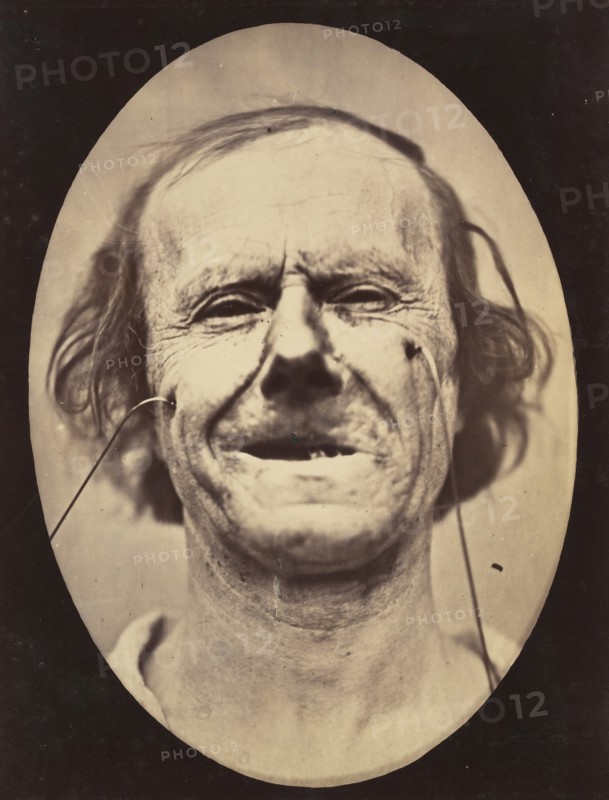 Figure 48: Mild weeping, pity and feeble false laughter , 1854-56, printed 1862.