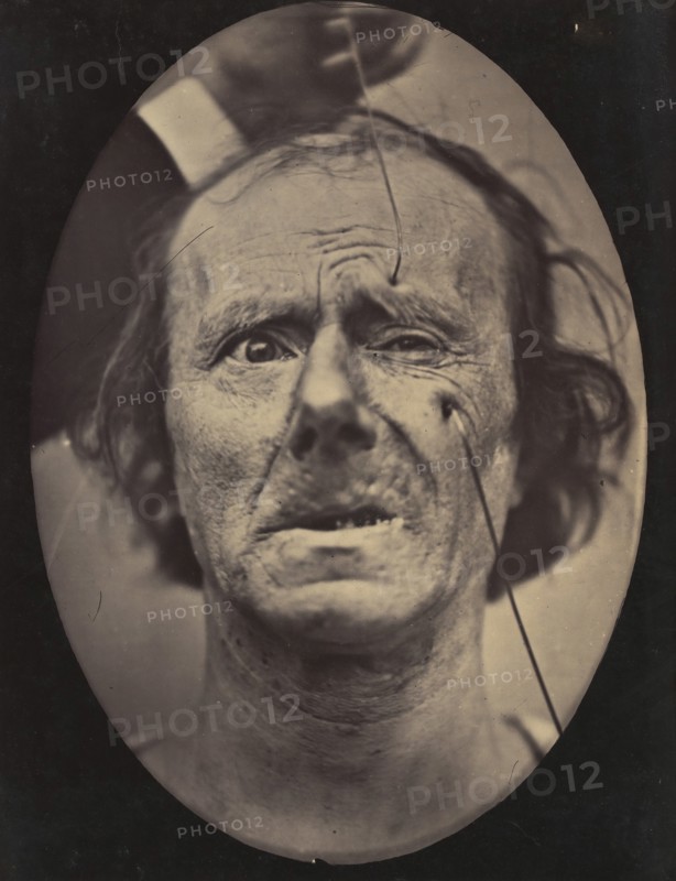Figure 49: Painful weeping and forward looking., 1854-56, printed 1862.