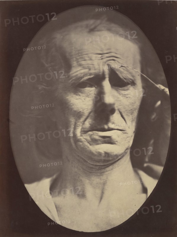 Figure 22: No painful expression , 1854-56, printed 1862.