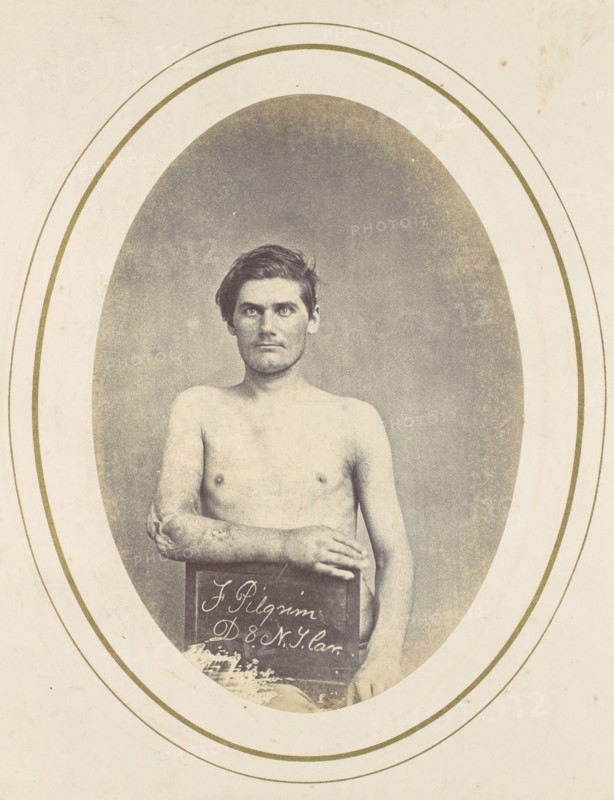 Frederick Pilgrim, 1865.