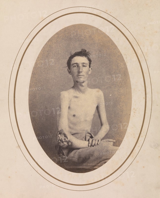 Private James H. Stokes, Company H, 185th New York Volunteers, April-May 1865.