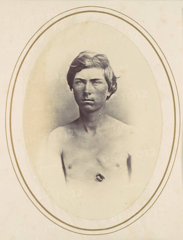Frederick A. Bentley, 1865.