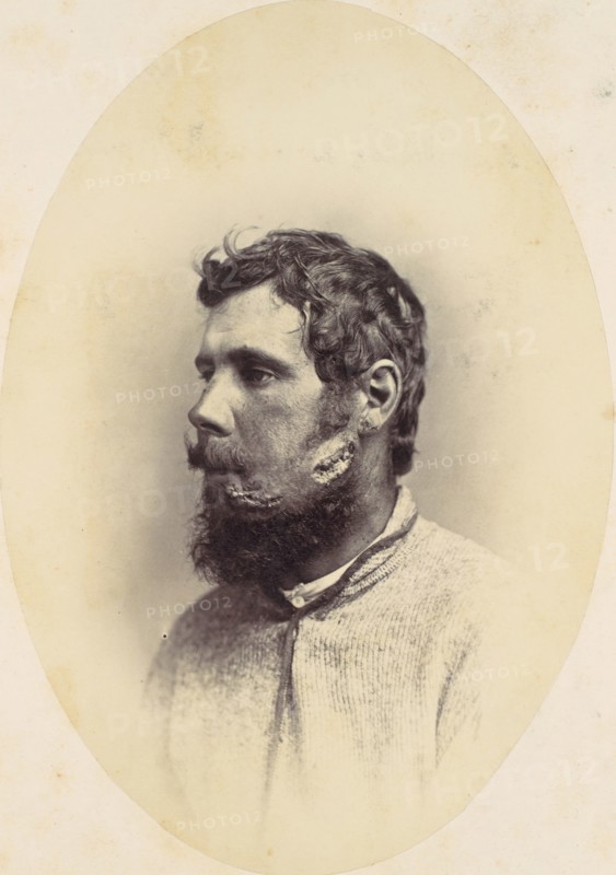 Andrew Wagoner, 1865.
