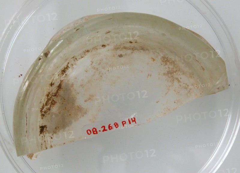 Foot of a Vessel