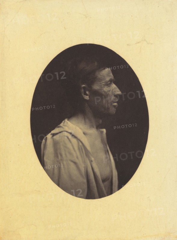 A portrait, seen in profile, of a man 42 years old, stupefied by the abuse of alcohol; his nose is aquiline, 1854-1856, printed 1862.