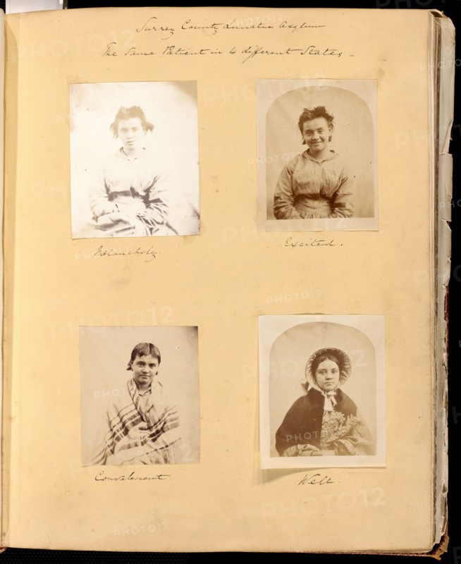 Untitled [Surrey County Lunatic Asylum - the Same Patient in 4 different States], 1849/60.  Creator: Hugh Welch Diamond.