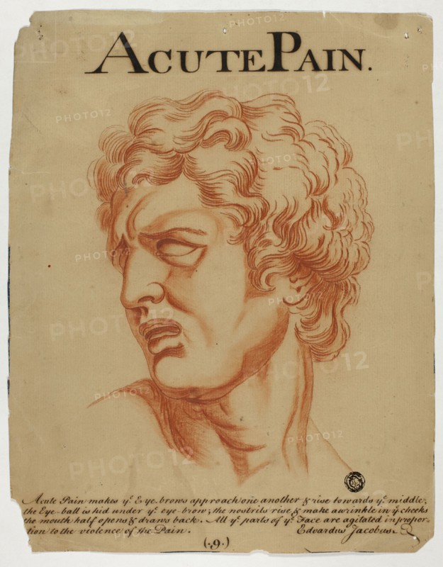 Acute Pain, after 1698. Creator: Eduardus Jacobus.