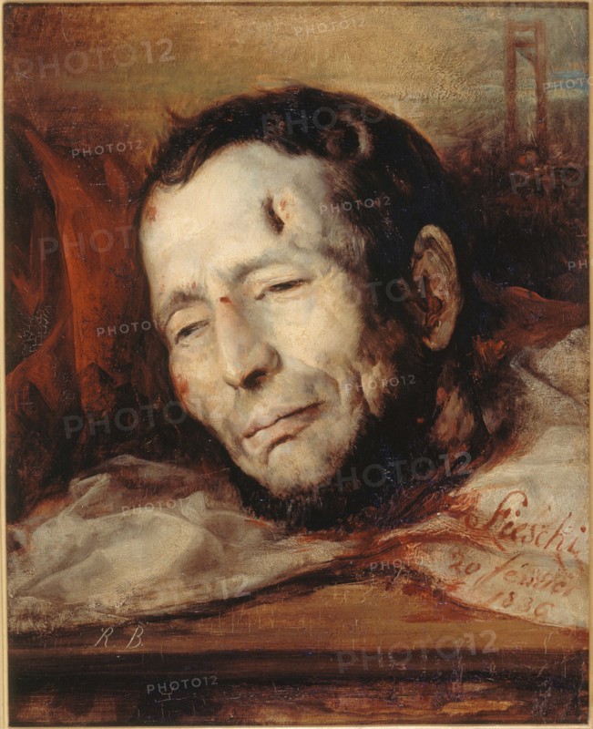 Head of Giuseppe Fieschi (1790-1836), after his execution, 1836.