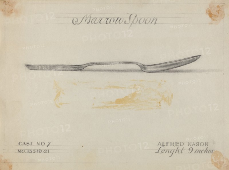 Silver Marrow Spoon, c. 1936.