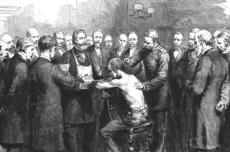 ''Dr. Koch's Treatment for Consumption at the Royal Hospital, Berlin; Professor Pfuhl Innoculating a Creator: Unknown.