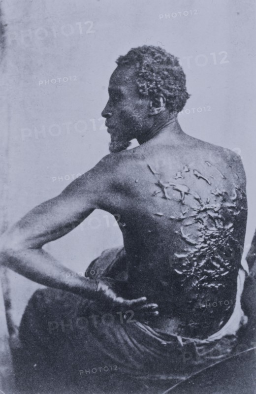 The Scourged Back- The furrowed and scarred back of Gordon, a slave who escaped..., Louisiana, 1863. Creators: Unknown, C. Seaver, Jr..