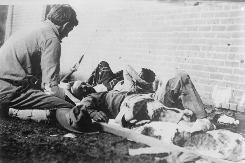 Wounded at Juarez, between c1910 and c1915. Creator: Bain News Service.