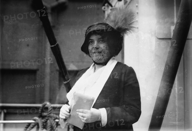 Frances Alda, 1913. Creator: Bain News Service.