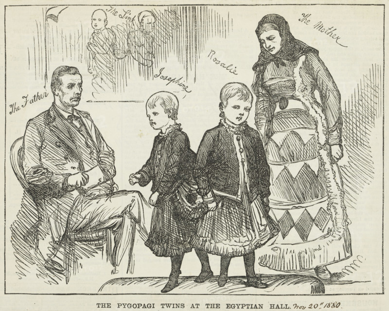 The Pyopagi Twins shown at Egyptian Hall, 1880. Pygopagi twins are conjoined at the buttocks. Josephine and Rosalie were shown at the Egyptian Hall, Piccadilly in 1880.Showmanship was a hard business. People and animals with unusual characteristics were ruthlessly exploited and there was little care for them once they lost their popularity with the audience.