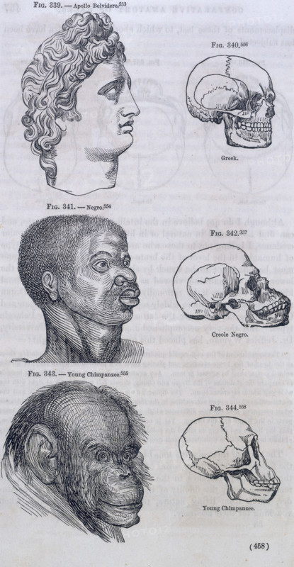 Three faces compared with skulls, 1854. 'Fig. 339. - Apollo Belvidere; Fig. 340. Greek; Fig. 341. - N*gro; Fig. 342. Creole N*gro; Fig. 343. - Young Chimpanzee'. Victorian diagram illustrating the hierarchy of development whereby it was believed that Europeans were more 'advanced' than Africans. The head at the top has been copied from a Greek sculpture of Apollo Belvedere.