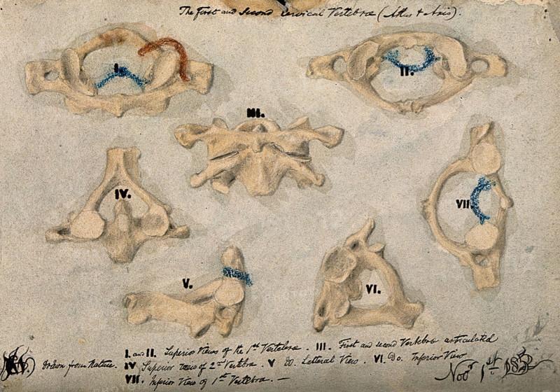 The first and second cervical vertebrae, 1852/11/09. Creator: J.C. Whishaw.