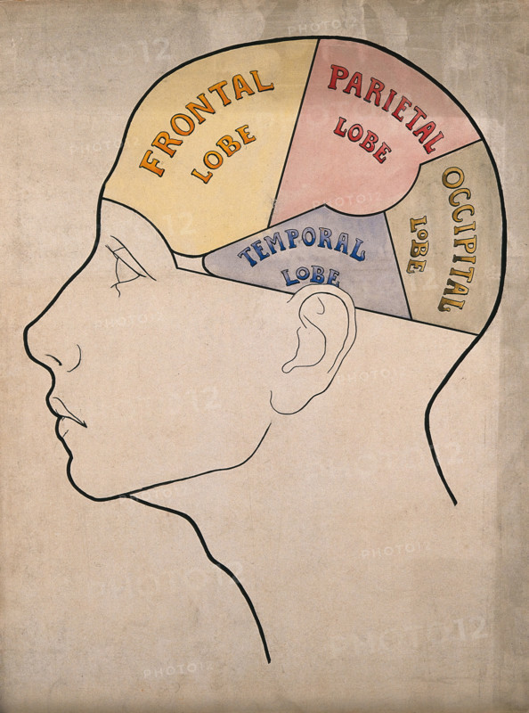 Head of "a backward boy" divided into four cerebral lobes: profile, c1900. Creator: Bernard Hollander.