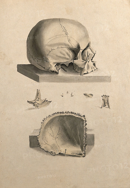 Human skull: six figures showing sections and an entire skull, 1830-1835. Creator: Unknown.