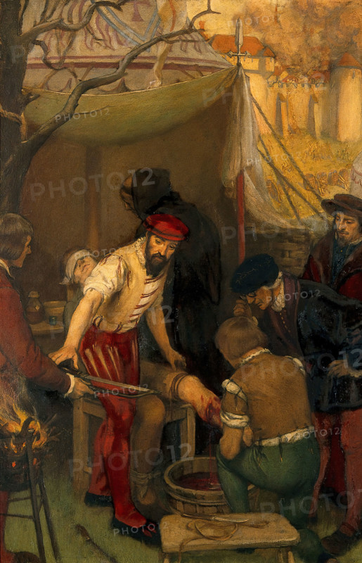 Ambroise Paré using the ligature when amputating at the siege of Damvillers, 1552, c1912. Creator: Ernest Board.