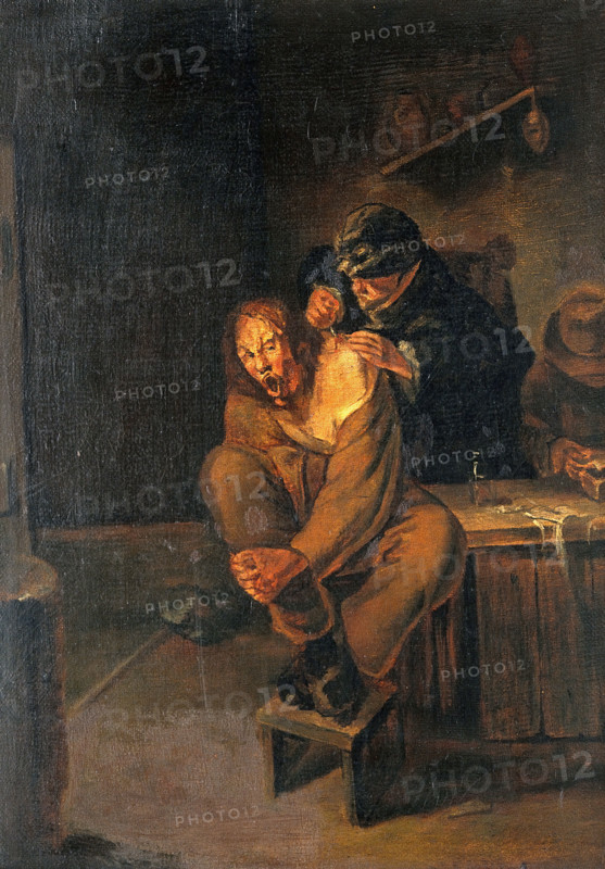 A surgeon operating on a man's shoulder, c1640s. Creator: Unknown.