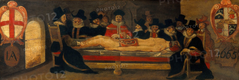 The dissection of a corpse before a company of surgeons, c1665. Creator: Unknown.