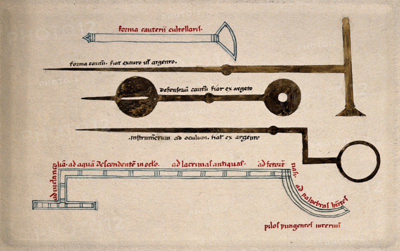 Surgical instruments, including cauterising needles. Creator: Unknown.
