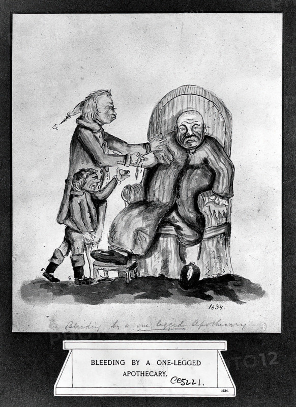 A surgeon-apothecary bleeding a patient, his servant boy catches the drops. Creator: Unknown.