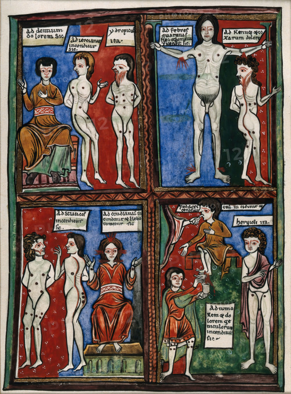 Four vignettes demonstrating different cauterisation points on naked human bodies. Creator: Unknown.
