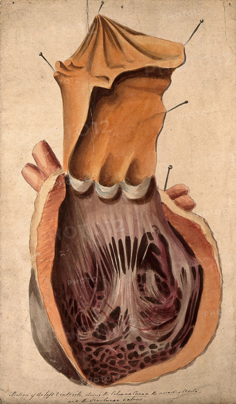 Dissected heart: section of the left ventricle, 1800-1899. Creator: Unknown.