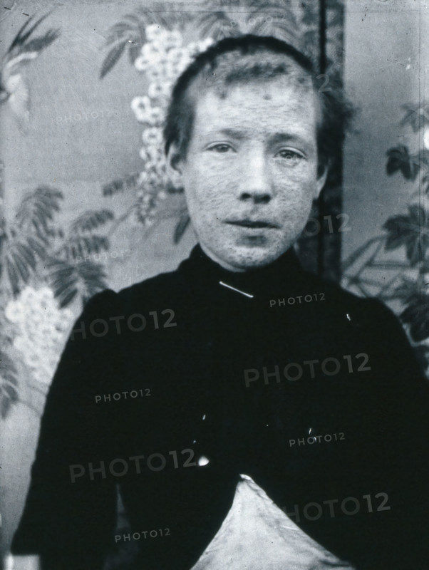 Gloucester smallpox epidemic, 1896: Ethel Cromwell, aged about 14 years, as a smallpox patient, 1896 Creator: HCF of Gloucester.