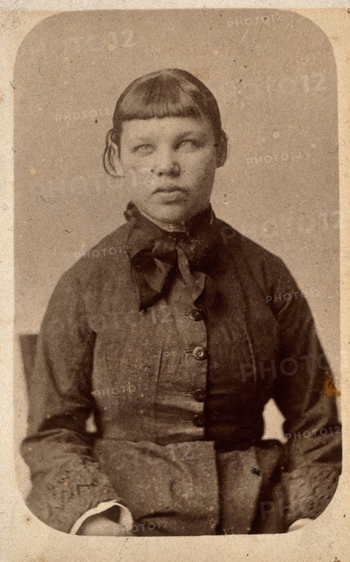 A young woman with a short fringe, showing signs of mental deficiency, c1860s. Creator: John Davis.