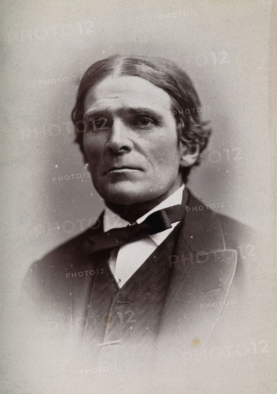 Sir John Scott Burdon-Sanderson, 1881. Creator: George Milner Gibson Jerrard.