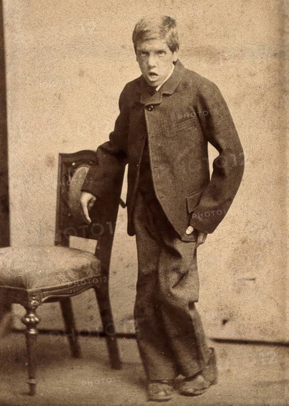 A young man, showing signs of mental deficiency, leaning awkwardly..., c1890s. Creator: Davis.