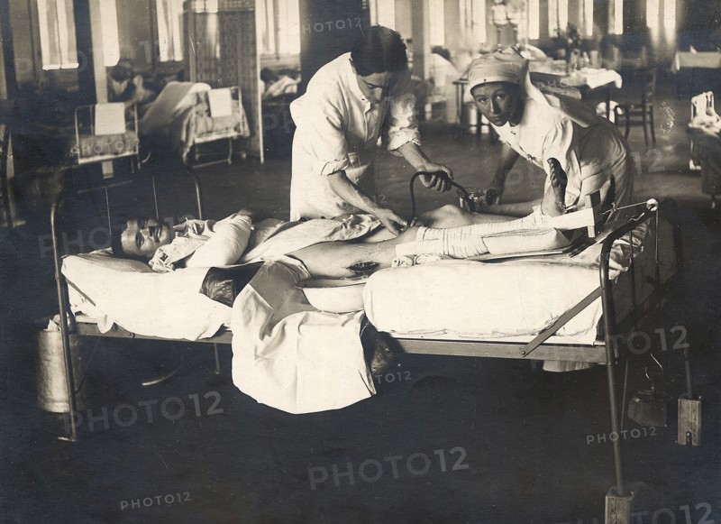 Dans un hôpital militaire à l'arrière du front, un médecin avec l'aide d'une infirmière, donnent des soins à un soldat blessé à une jambe - La première guerre mondiale 1914-1918.