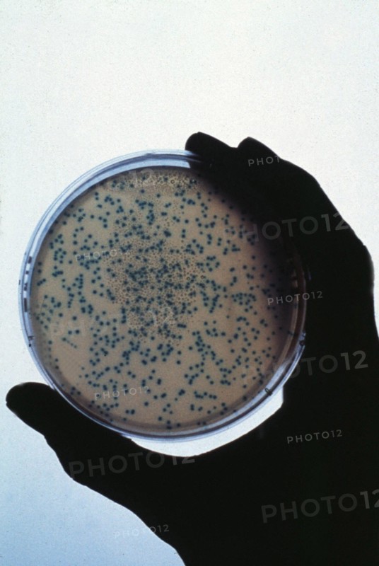 Petri Dish Culture
